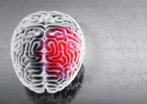 哪些预警信号可以帮助我们识别脑卒中？